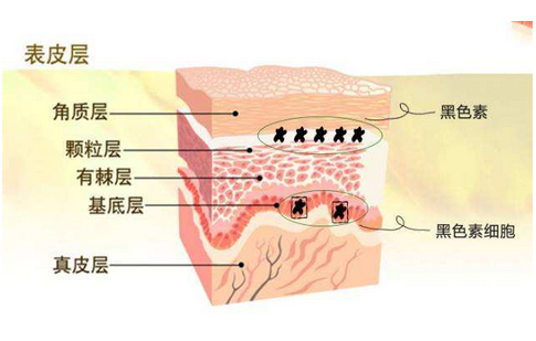 烧伤引起的白癜风怎么治效果好