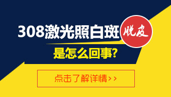 局限型白癜风白斑应该如何治疗